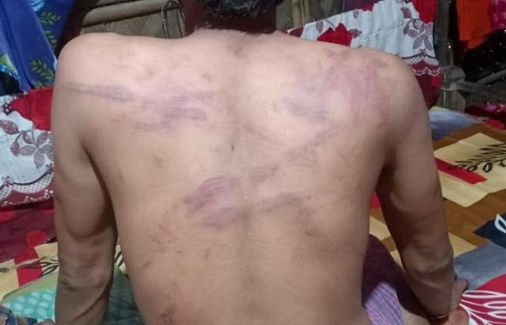 Bishramganj : Man was beaten up severally by Miscreants, looted cash and mobile phone in the darkness of night